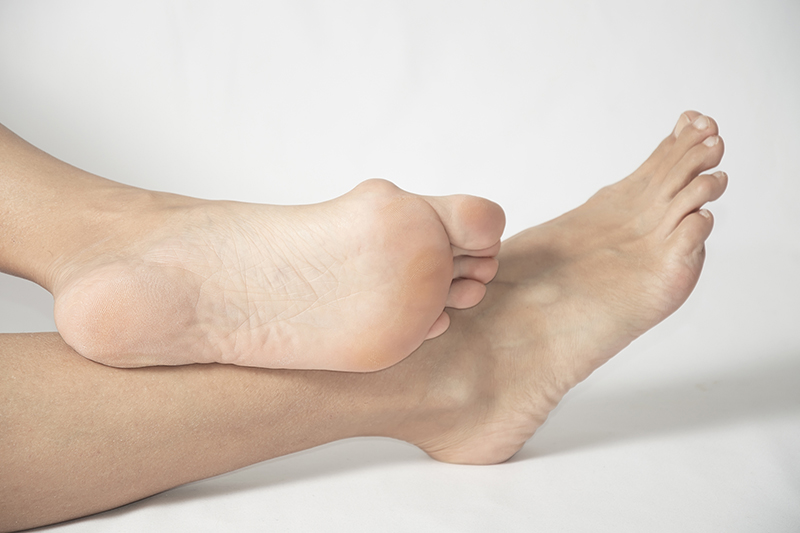 Tips on Managing Bunions Without Surgery
