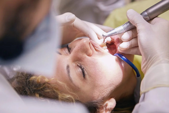 Aftercare and Maintenance Tips for Dental Bonding